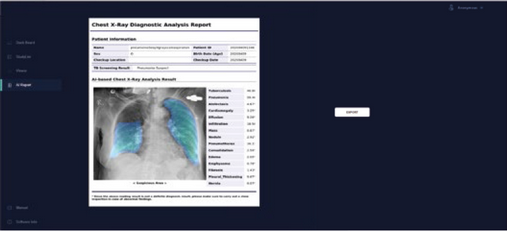 Covid 19 - software di generazione del report radiografie digital