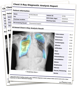 Covid 19 - report dell'analisi radiografica digitale